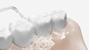 Xiaomi Water Flosser 2 EU / ústna sprcha